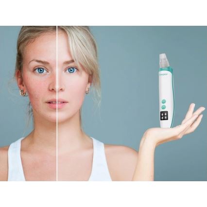 Beper - Презареждаем уред за почистване на пори, USB/5V, 400 mAh